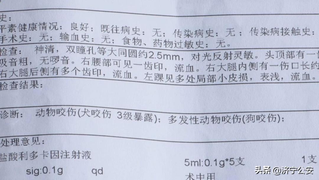 犬病的发现及护理常识,犬伤处置规范最新指南