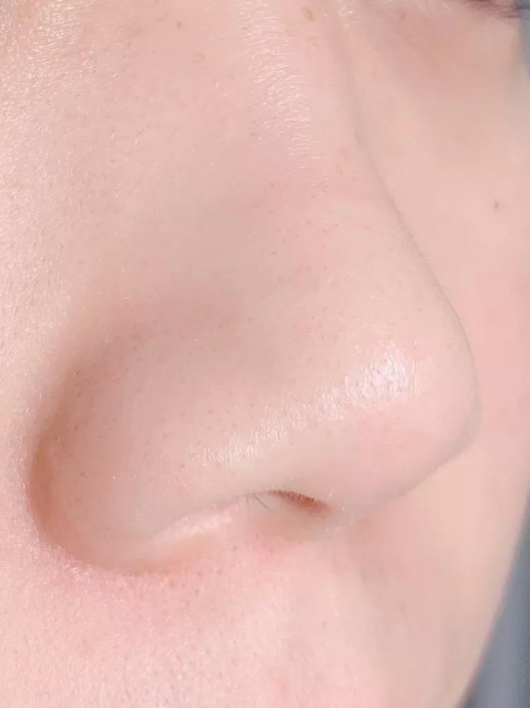 怎么把皮肤养得干净通透,现在皮肤也好多了