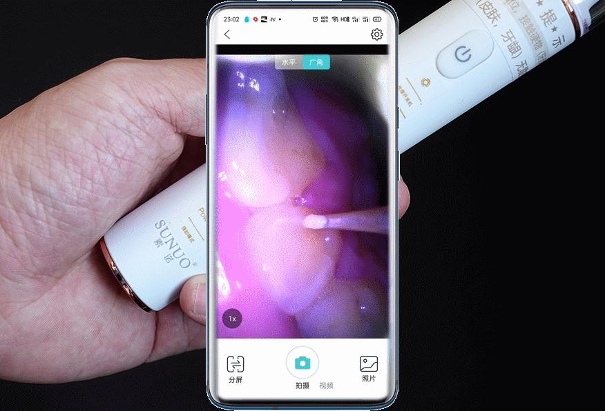 智能可视超声波洁牙仪洗牙步骤,牙科用的超声波洁牙设备