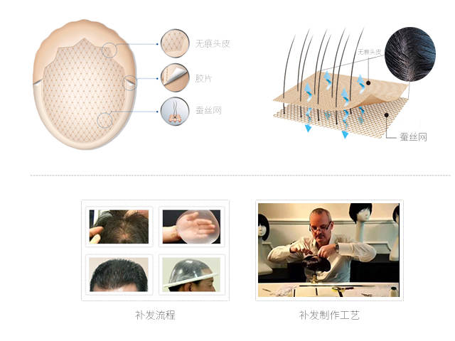 织发补发山东,织发补发的发展