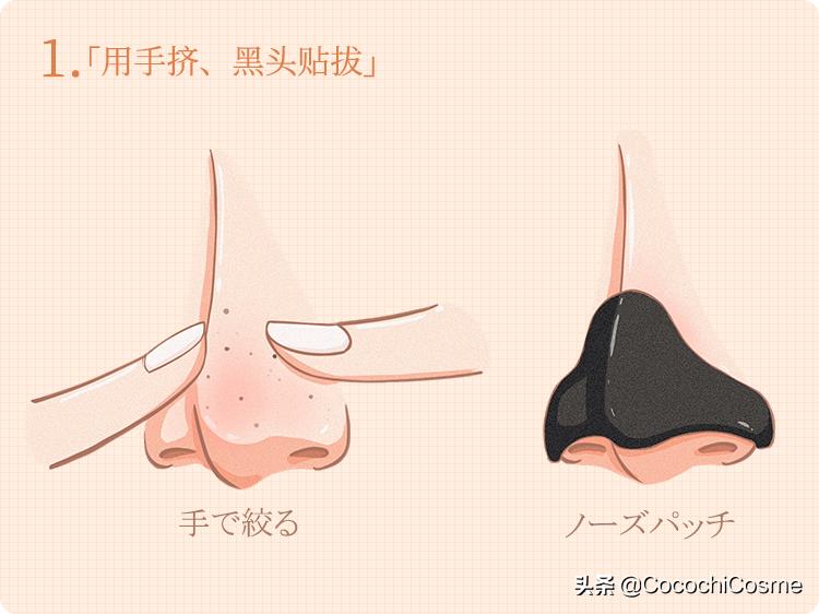用芦荟擦黑头会去掉黑头吗,黑头铲能去除所有黑头吗