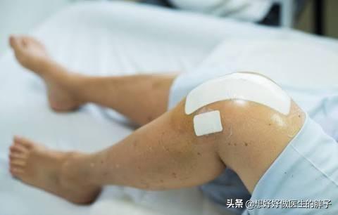 骨折膝关节粘连到哪里康复好,骨折后膝关节粘连怎么锻炼