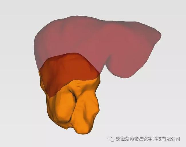 紫薇帝星穴,紫薇帝星医疗科技