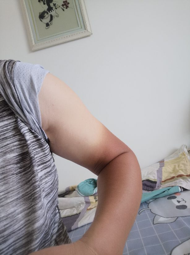 云南黑皮肤少年,云南黑皮肤