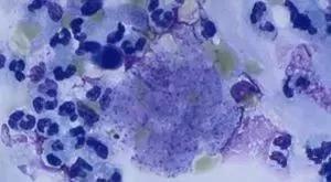 有毒试剂都有哪些,这16种最毒试剂你在用吗