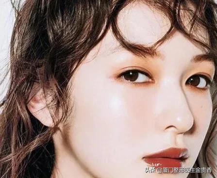 纳米无痕埋线双眼皮需不需要拆线,纳米无痕双眼皮动画操作过程视频