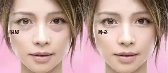 眼袋毁颜值吗,眼袋毁了怎么消除