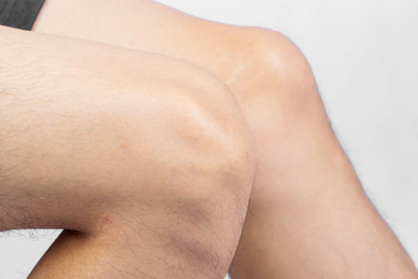 经常步行如何保养膝盖,长期不锻炼如何恢复膝盖