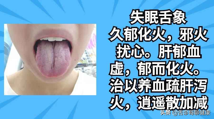 舌诊哥舌象分析视频,舌诊歌健康问答全集