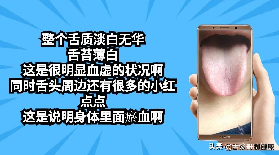 抖音舌诊哥舌象感悟：遗精滑精、关节疼痛、孤独、无助