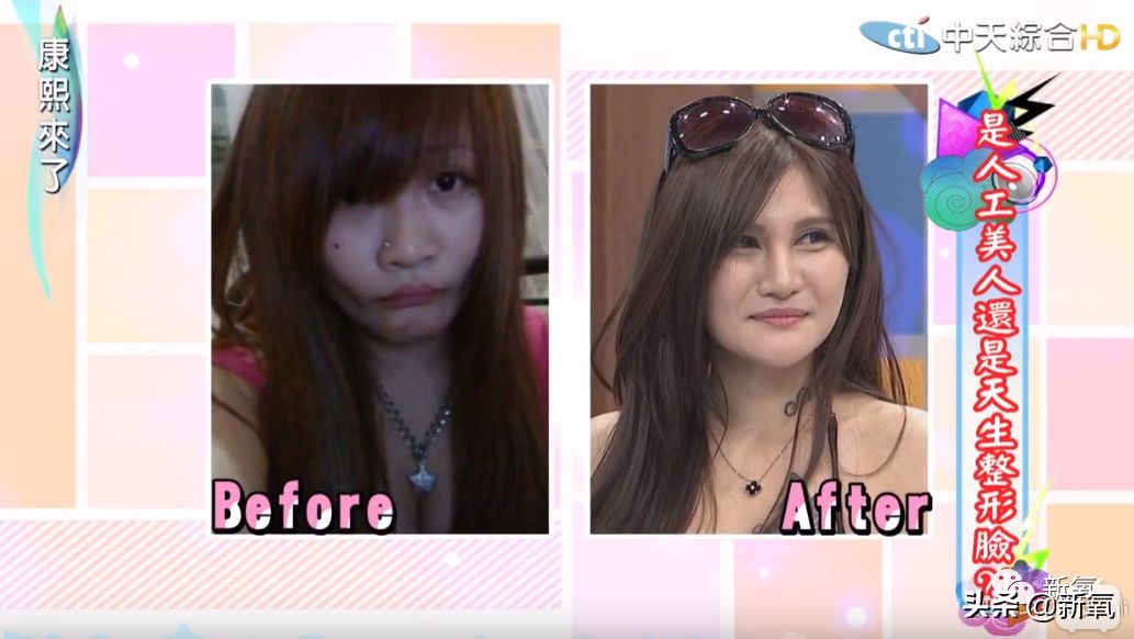 花90万从头整到脚,还可以这么自然?旁边纯天然小姐姐都看懵了