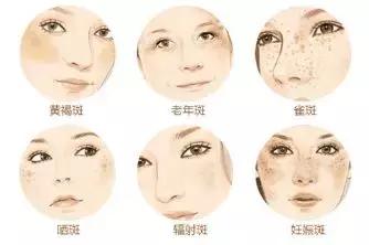只需3步淡化斑点,简单4招快速淡化色斑