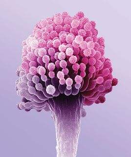 霉菌是什么病图片,霉菌是啥