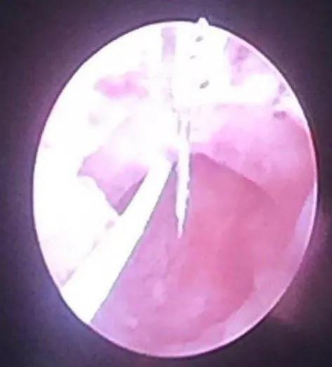 名医札记,名医札记张家华