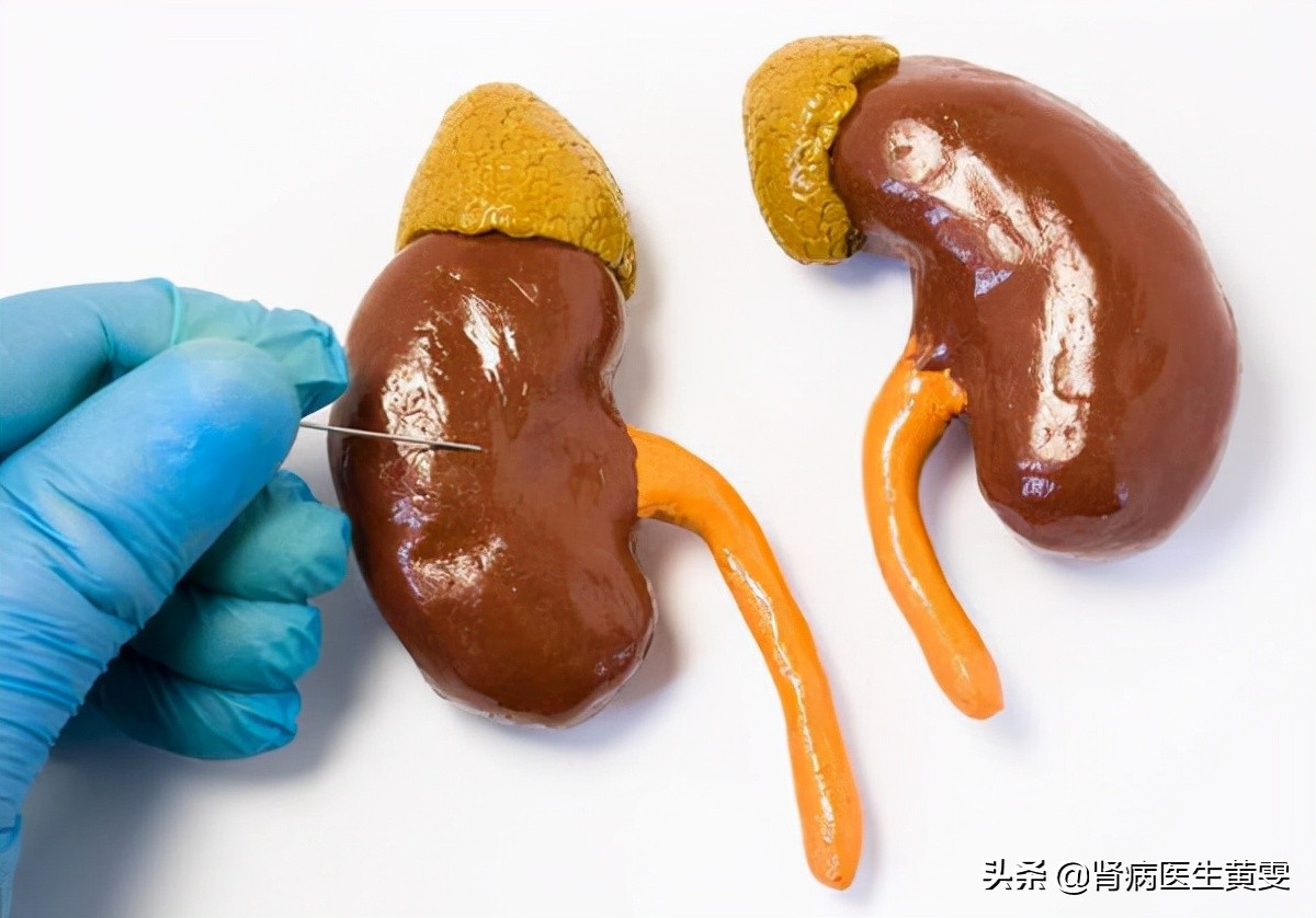 糖尿病肾衰适合吃什么粗杂粮,糖尿病吃药会对身体造成什么影响