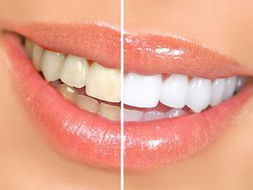 牙齿矫正有一颗倒了,牙齿矫正后又歪了谁负责