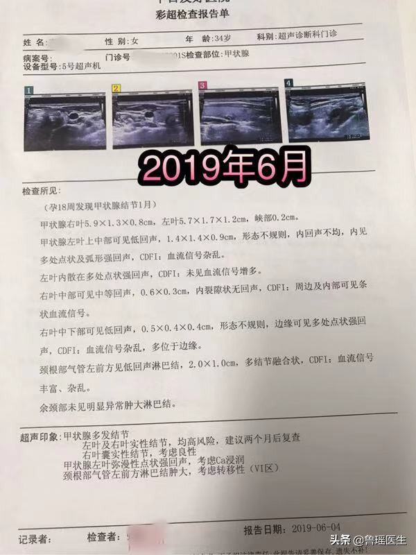 甲状腺癌手术后发现怀孕了能要吗,怀孕期间发现甲状腺癌