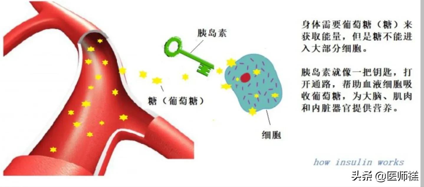 什么是胰岛素抵抗如何治疗,什么是胰岛素抵抗如何逆转