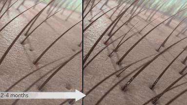 明星亲测|康王创始人83岁再出山，挑战5天内不洗头