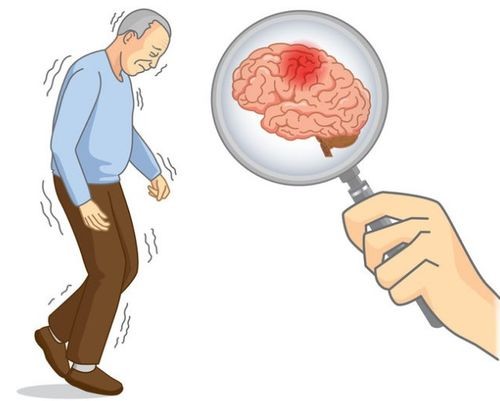 一旦脑梗发生还能治愈吗,一旦得了脑梗就要终身服药