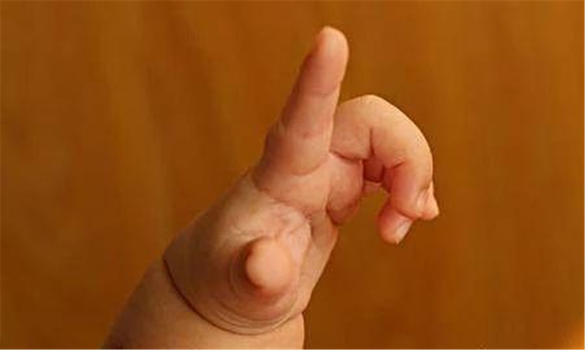 宝宝喜欢用手抓脸是什么原因,为啥小婴儿总爱打脸