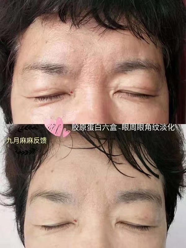 董欣胶原蛋白饮,董欣暖欣代理价