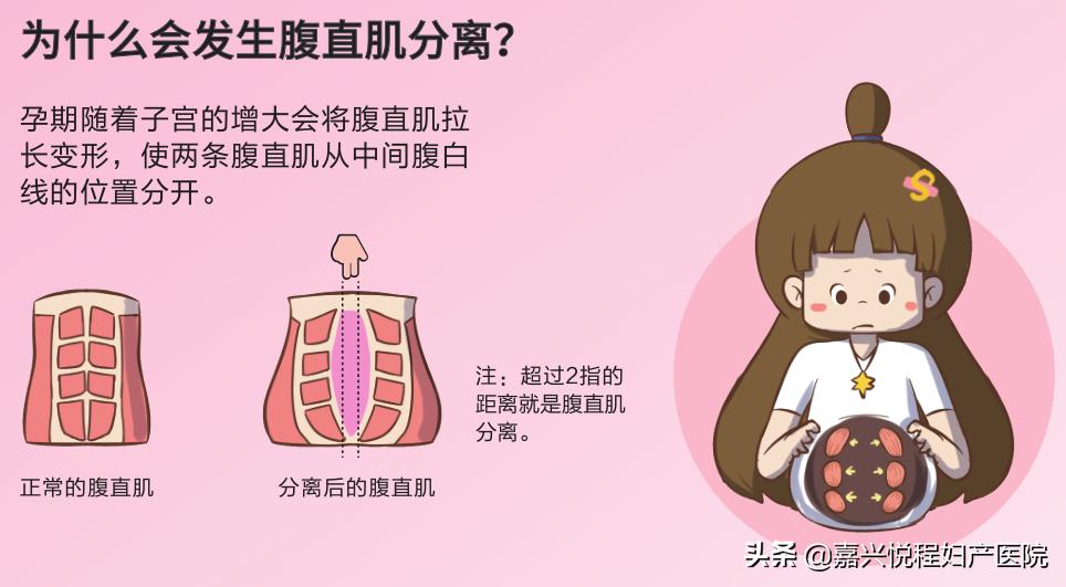 产后恢复怀孕,产后恢复让你紧致如初