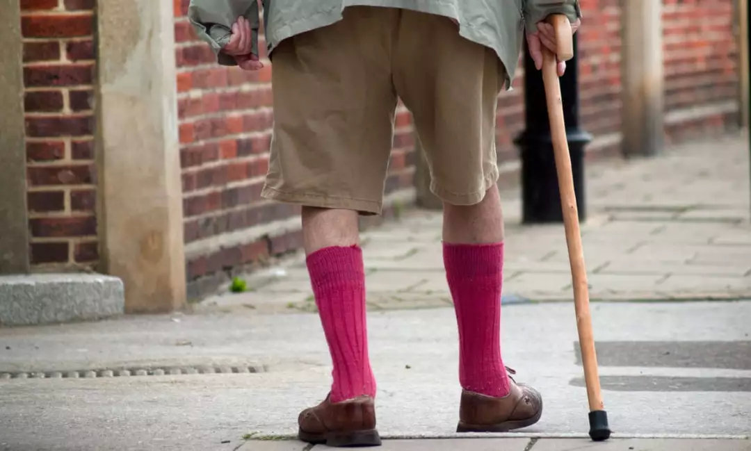 静脉曲张老年人手术,老年人静脉曲张要不要做手术