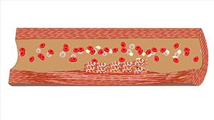 剖宫产的孩子和顺产的孩子的区别,一胎剖宫产二胎顺产的几率有多大