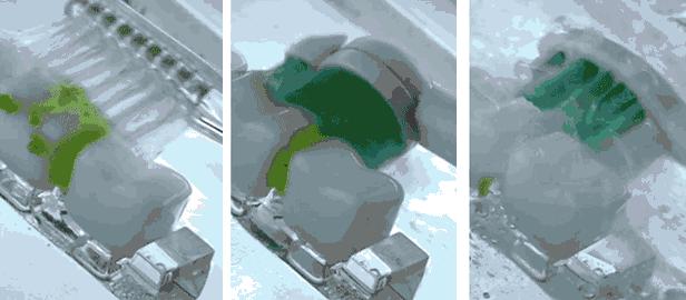 长期刷牙牙龈出血,为什么拿电动牙刷刷牙老牙龈出血