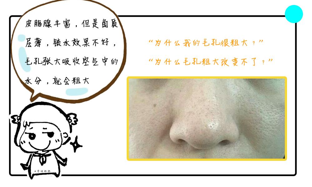 易出油皮肤怎么改善,混干皮t区出油怎么化妆