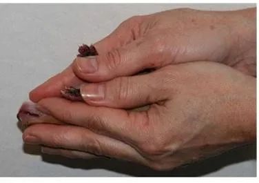 猫宫庄园大幅度提高新生小猫出生率的助产方法