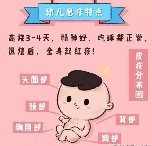 宝宝出现幼儿急疹怎么办,宝宝幼儿急疹怎么护理