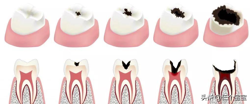 草莓籽藏在牙里发芽了,草莓籽在嘴里发芽