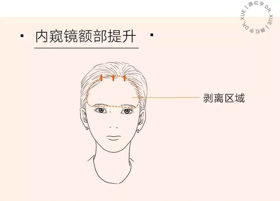 眼部抗衰最好方法,眼部抗衰效果图