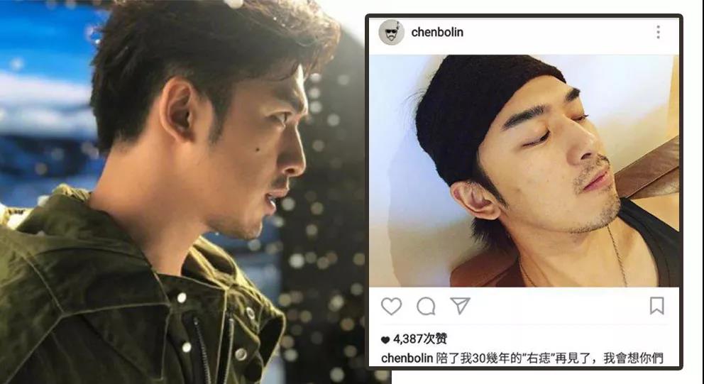 长在什么部位的痣最危险,长在哪些部位的痣需要特别注意