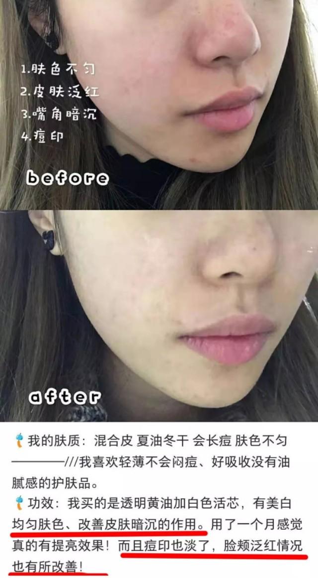 夏天到了涂什么,夏季适合用什么保湿乳液