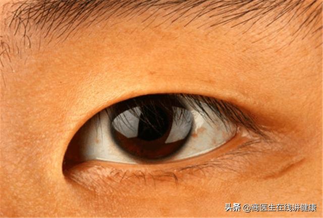 几块钱的维生素b2竟有如此奇效,维生素b2可以治炎症吗