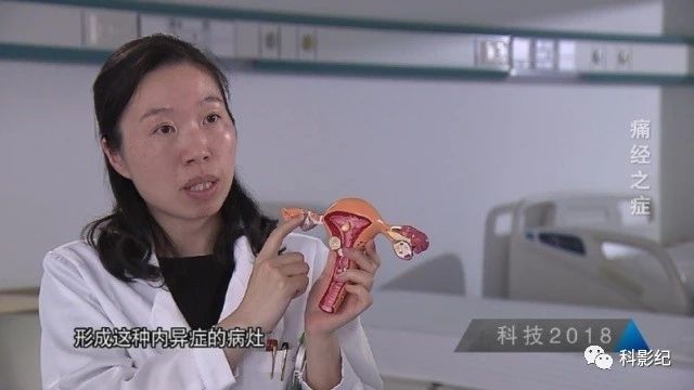 什么原因会引起痛经,痛经喝红糖水真的有用吗