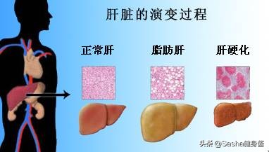破解喝酒之谜,如何尽快解决啤酒肚