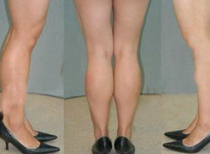 如何14天练出完美小腿,怎么练成小腿细长