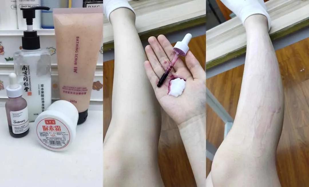 夏天露肉的季节,露肉的正确美白方法