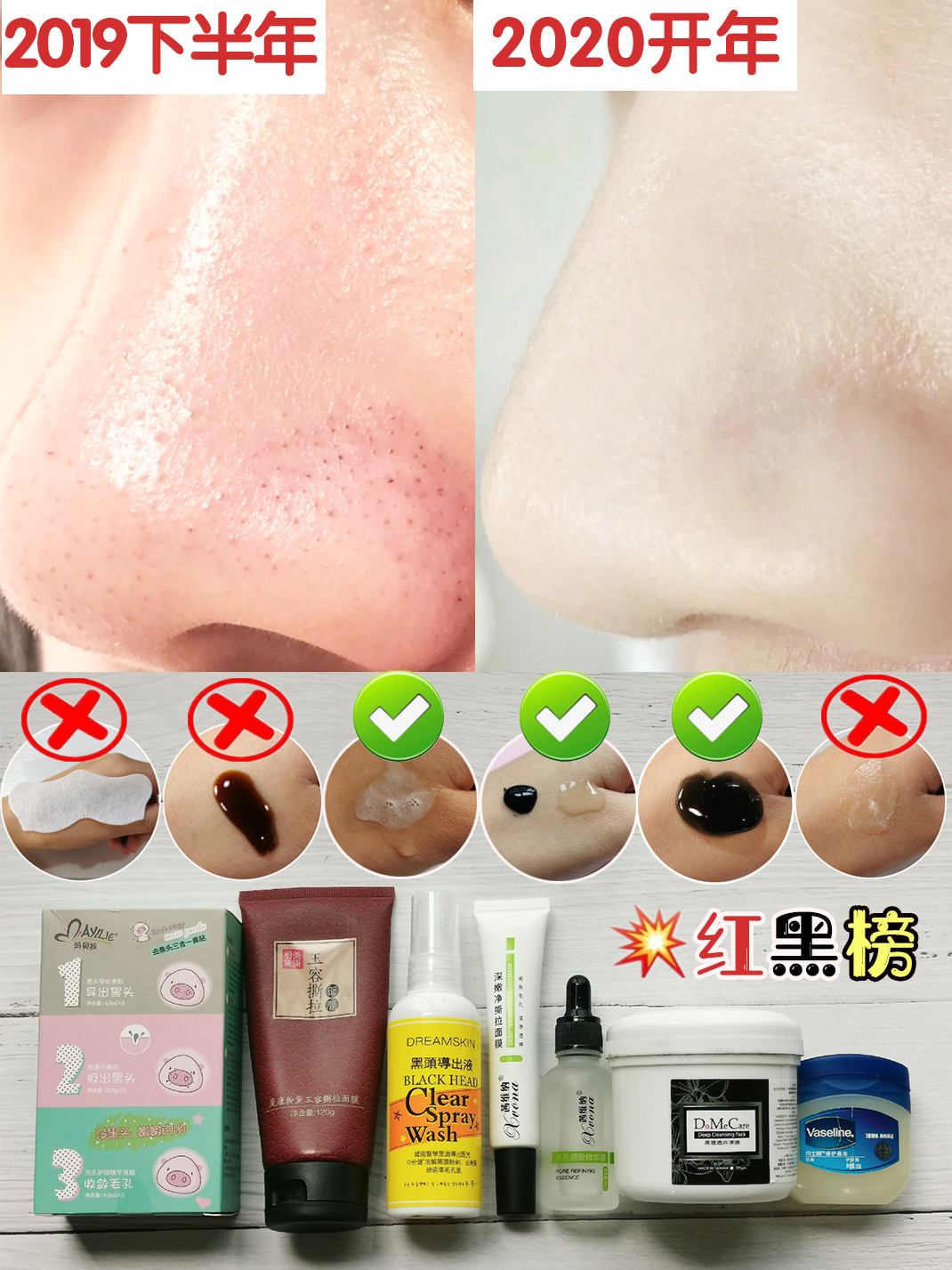 去黑头清洁产品比较好,清洁黑头产品排行榜第一名