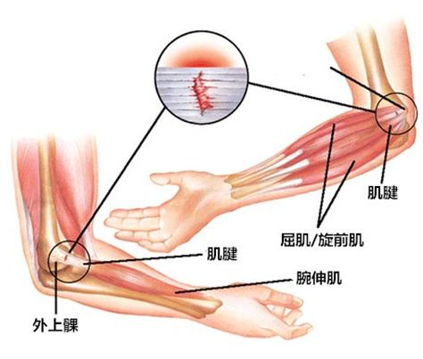 胳膊疼痛咋回事呀,胳膊疼痛咋回事