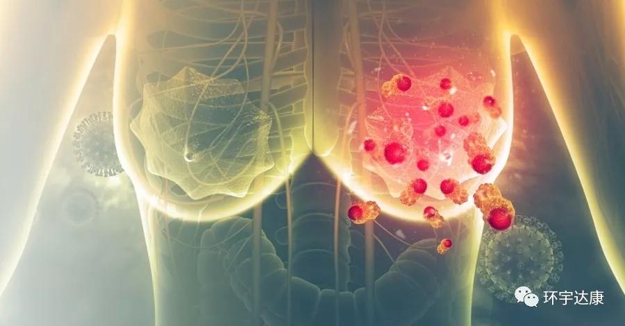 乳腺癌新药abemaciclib获批,乳腺癌新药erso最新消息