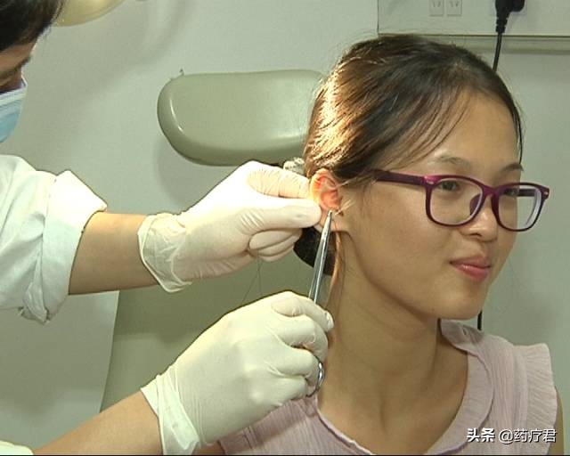 女生打耳洞多年后长出大疙瘩,十几岁的女孩打耳洞老发炎咋办