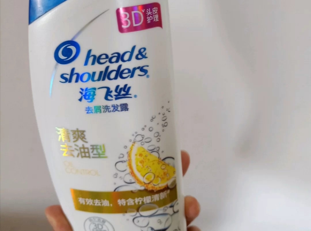 头发天天洗的很干净还是很痒,头发痒跟有虫子爬似的是怎么回事