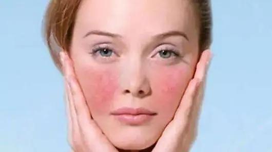 干燥皮肤瘙痒用什么药有效,皮肤皲裂干燥还伴有痒怎么办