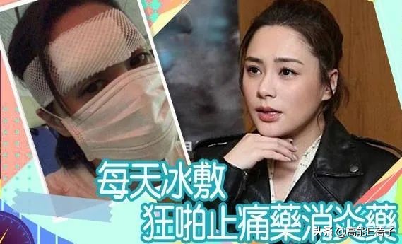 阿娇额头伤口恢复过程,阿娇晒伤口恢复照