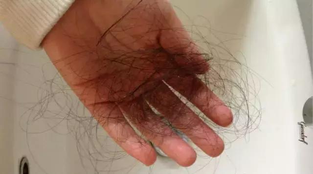 璋冨懗鏂欐湁鍝簺鍙互娌荤梾,濡囩璋冩枡